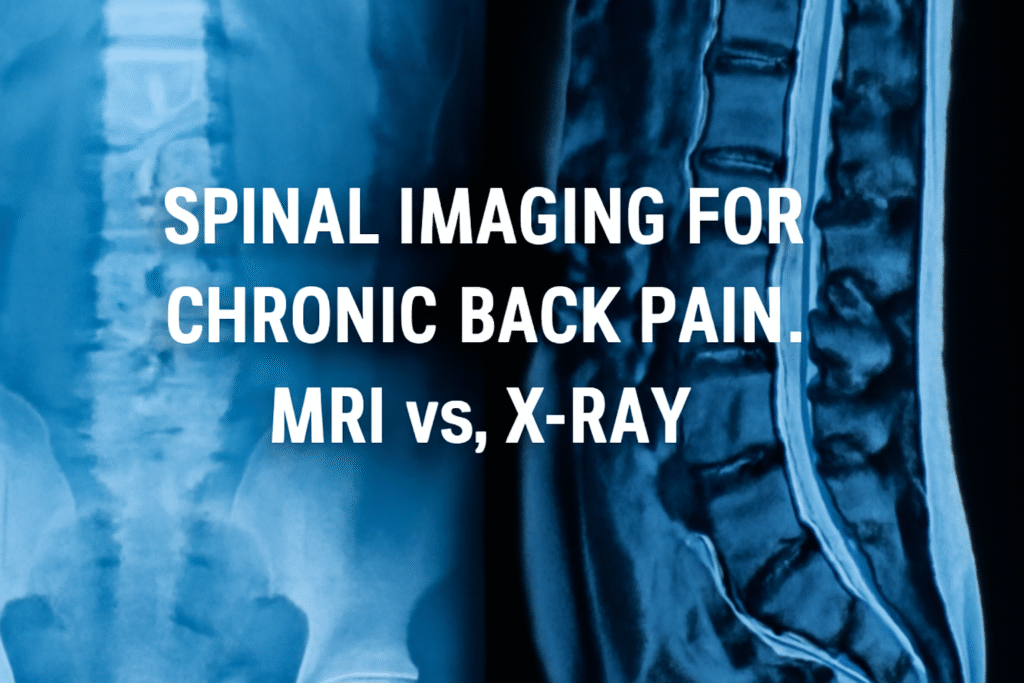 Explore the differences between MRI and X-ray for spinal imaging for chronic back pain. Understand which imaging technique is most effective for diagnosing back pain.