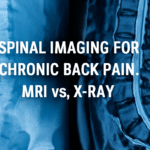 Explore the differences between MRI and X-ray for spinal imaging for chronic back pain. Understand which imaging technique is most effective for diagnosing back pain.