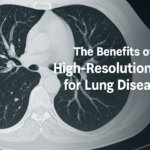Discover the benefits of high-resolution CT for lung diseases, enabling early detection, precise assessment, and better management of respiratory conditions.