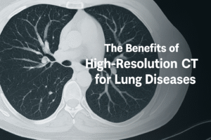 Discover the benefits of high-resolution CT for lung diseases, enabling early detection, precise assessment, and better management of respiratory conditions.