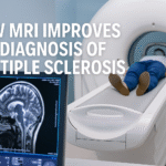 Explore how MRI improves the diagnosis of multiple sclerosis by detecting lesions early, monitoring disease progression, and guiding treatment decisions.