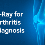 Learn how X-Ray for arthritis diagnosis helps detect joint changes and monitor disease progression to ensure effective treatment and management.